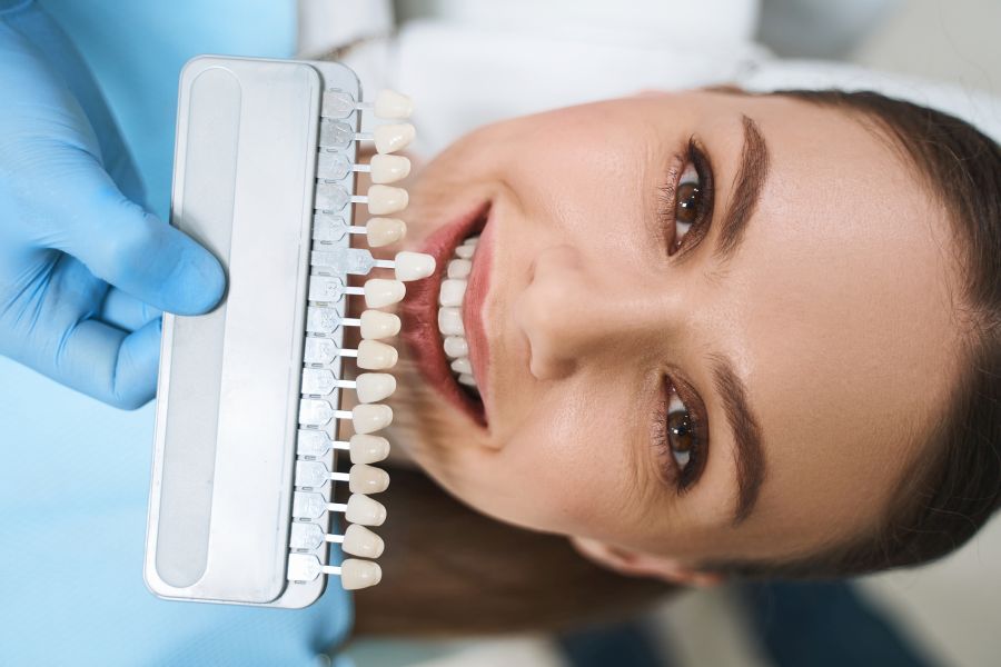 veneers-feher Veneers Korrekturmöglichkeiten - Smile Lounge